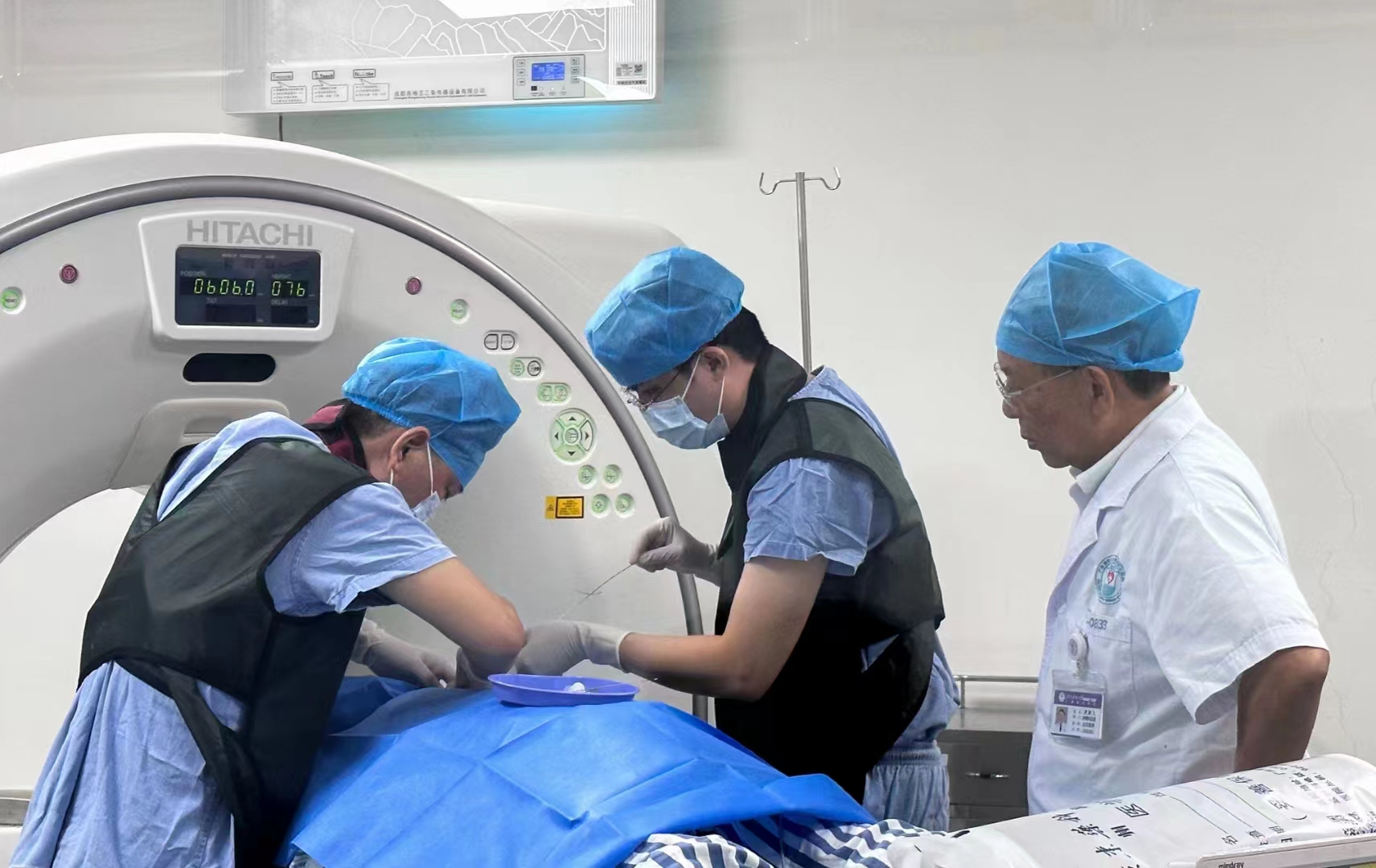 What to Do About Recurrent Intracranial Tumors? Particle Implantation for Fine Internal Radiotherapy Can Help